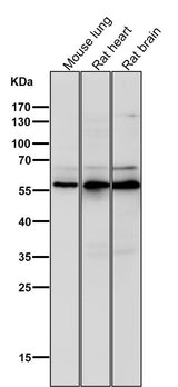 Anti-Phospho-AKT1 (S124) Rabbit Monoclonal Antibody Boster Bio
