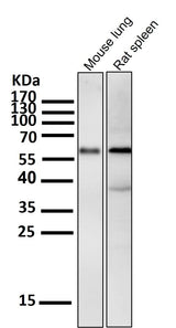 Anti-Phospho-Akt (Ser473) AKT1 Rabbit Monoclonal Antibody Boster Bio