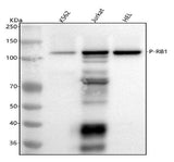 Anti-Phospho-Rb (S807) RB1 Rabbit Monoclonal Antibody Boster Bio