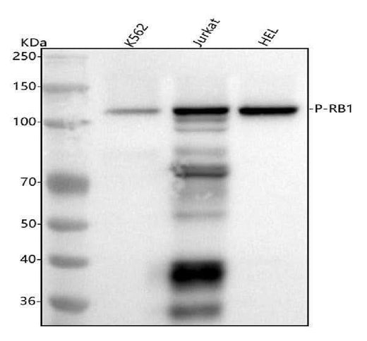 Anti-Phospho-Rb (S807) RB1 Rabbit Monoclonal Antibody Boster Bio