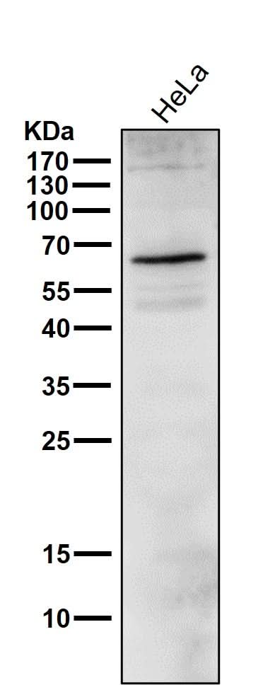 Anti-Phospho-ER alpha (S118) ESR1 Rabbit Monoclonal Antibody Boster Bio
