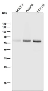 Anti-Phospho-Smad3 (S423 + S425) Rabbit Monoclonal Antibody Boster Bio