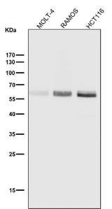 Anti-Phospho-Smad3 (S423 + S425) Rabbit Monoclonal Antibody Boster Bio