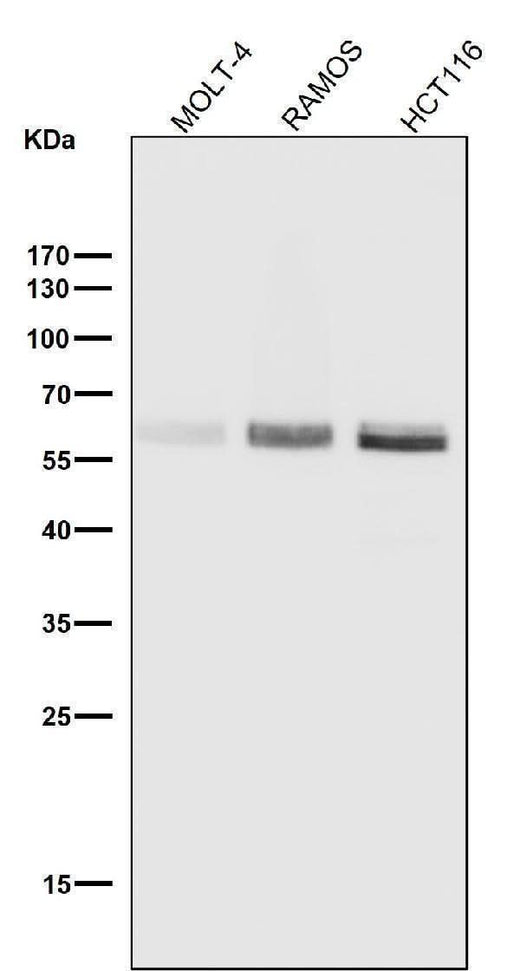 Anti-Phospho-Smad3 (S423 + S425) Rabbit Monoclonal Antibody Boster Bio