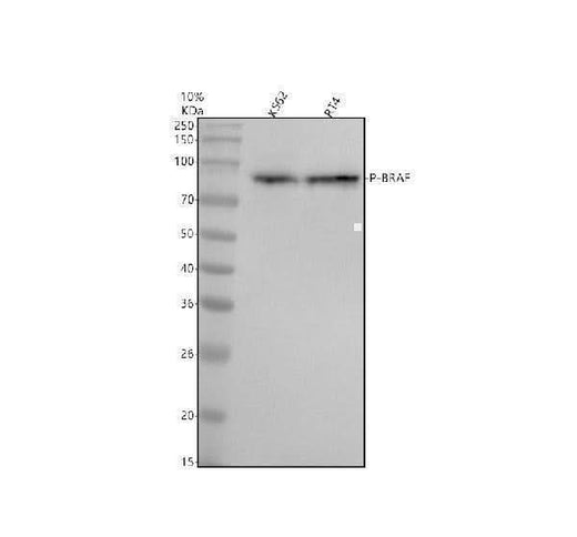 Anti-Phospho-B Raf (T401) Rabbit Monoclonal Antibody Boster Bio