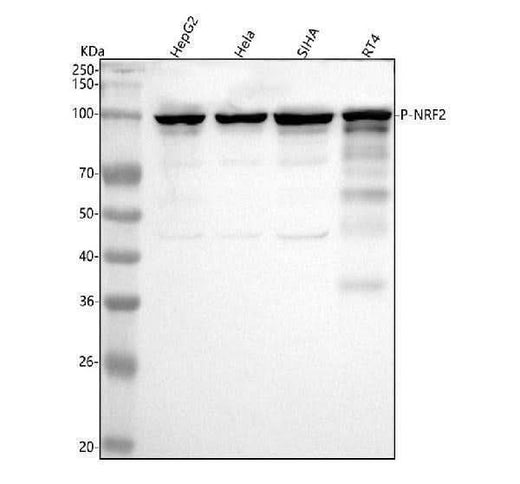 Anti-Phospho-Nrf2 (S40) NFE2L2 Rabbit Monoclonal Antibody Boster Bio