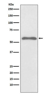 Anti-Phospho-Smad2 (S255) Rabbit Monoclonal Antibody Boster Bio
