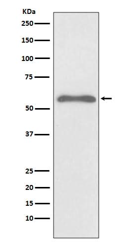 Anti-Phospho-Smad2 (S255) Rabbit Monoclonal Antibody Boster Bio