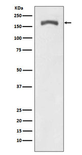 Anti-Phospho-PDGF Receptor beta (Y740) PDGFRB Rabbit Monoclonal Antibody Boster Bio