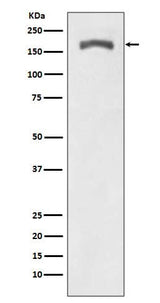 Anti-Phospho-PDGF Receptor beta (Y740) PDGFRB Rabbit Monoclonal Antibody Boster Bio