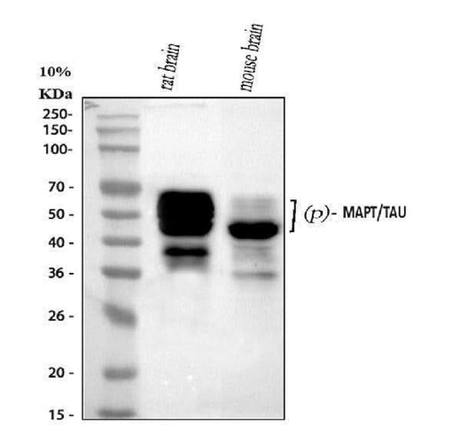 Anti-Phospho-Tau (T231) MAPT Rabbit Monoclonal Antibody Boster Bio