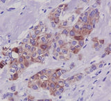 Anti-Phospho-Tau (S396) MAPT Rabbit Monoclonal Antibody Boster Bio