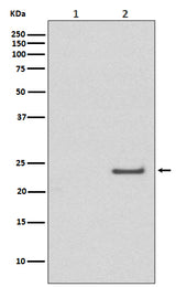 Anti-Phospho-Rac1/Cdc42 (Ser71) Rabbit Monoclonal Antibody Boster Bio