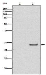 Anti-Phospho-Rac1/Cdc42 (Ser71) Rabbit Monoclonal Antibody Boster Bio