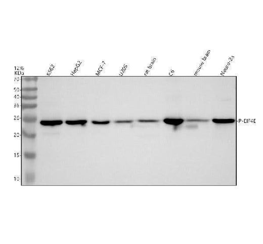 Anti-Phospho-eIF4E (S209) Rabbit Monoclonal Antibody Boster Bio