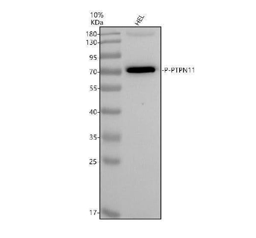 Anti-Phospho-SHP2 (Y542) PTPN11 Rabbit Monoclonal Antibody Boster Bio