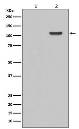 Anti-Phospho-FAK (Y397) PTK2 Rabbit Monoclonal Antibody Boster Bio