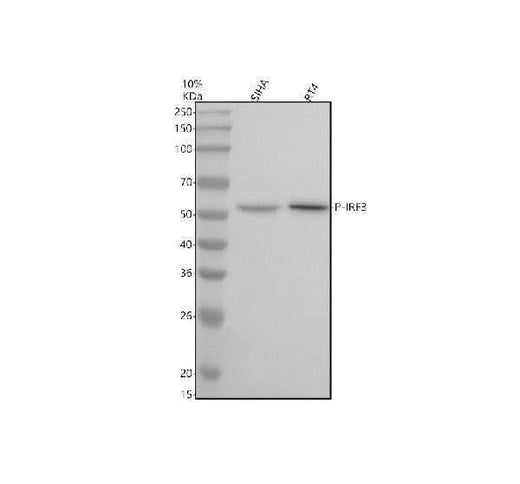Anti-Phospho-IRF3 (S386) Rabbit Monoclonal Antibody Boster Bio