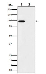 Anti-Phospho-FGFR3 (Y724) Rabbit Monoclonal Antibody Boster Bio