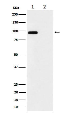 Anti-Phospho-FGFR3 (Y724) Rabbit Monoclonal Antibody Boster Bio