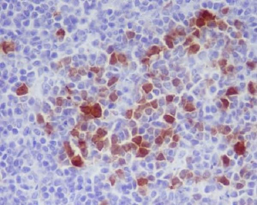 Anti-Phospho-Cdk1/2 (T14) Rabbit Monoclonal Antibody Boster Bio