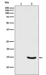Anti-Phospho-alpha Synuclein (S129) SNCA Rabbit Monoclonal Antibody Boster Bio