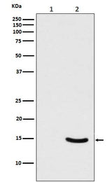 Anti-Phospho-alpha Synuclein (S129) SNCA Rabbit Monoclonal Antibody Boster Bio