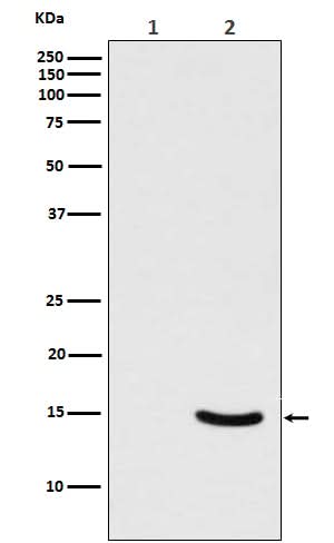Anti-Phospho-alpha Synuclein (S129) SNCA Rabbit Monoclonal Antibody Boster Bio