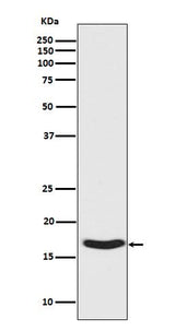 Anti-Phospho-alpha Synuclein (S129) SNCA Rabbit Monoclonal Antibody Boster Bio