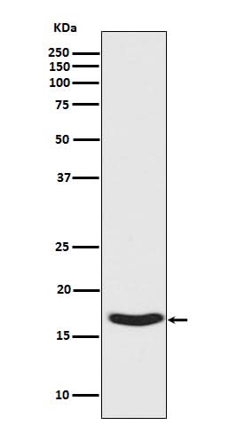 Anti-Phospho-alpha Synuclein (S129) SNCA Rabbit Monoclonal Antibody Boster Bio