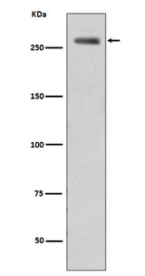 Anti-Phospho-LRRK2 (S935) Rabbit Monoclonal Antibody Boster Bio