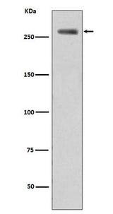 Anti-Phospho-LRRK2 (S935) Rabbit Monoclonal Antibody Boster Bio