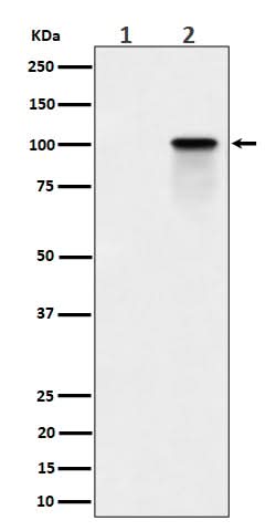 Anti-Phospho-Nucleolin (T84) Rabbit Monoclonal Antibody Boster Bio