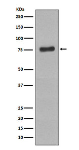 Anti-Phospho-BTK (Y223) Rabbit Monoclonal Antibody Boster Bio