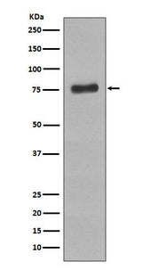 Anti-Phospho-BTK (Y223) Rabbit Monoclonal Antibody Boster Bio