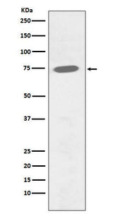 Anti-Phospho-BTK (Y551) Rabbit Monoclonal Antibody Boster Bio