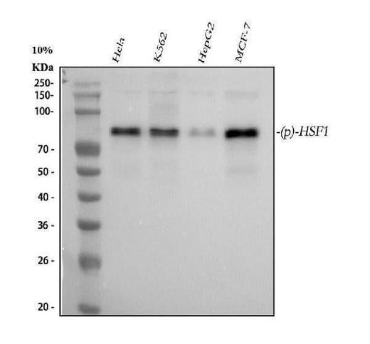 Anti-Phospho-HSF1 (S326) Rabbit Monoclonal Antibody Boster Bio