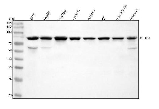 Anti-Phospho-NAK/TBK1 (S172) Rabbit Monoclonal Antibody Boster Bio