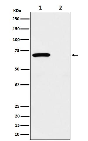 Anti-Phospho-Chk2 (T68) Rabbit Monoclonal Antibody Boster Bio