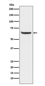 Anti-Phospho-NF-Kappa B p65 (S529) RELA Rabbit Monoclonal Antibody Boster Bio