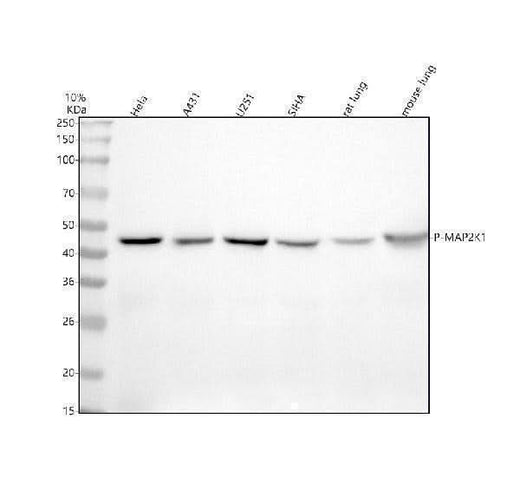 Anti-Phospho-MEK1 (S298) MAP2K1 Rabbit Monoclonal Antibody Boster Bio