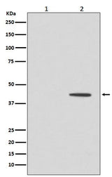 Anti-Phospho-MEK1 (T292) MAP2K1 Rabbit Monoclonal Antibody Boster Bio
