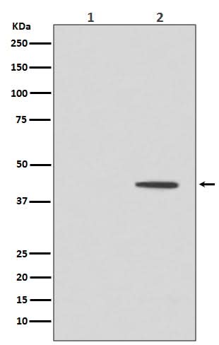 Anti-Phospho-MEK1 (T292) MAP2K1 Rabbit Monoclonal Antibody Boster Bio