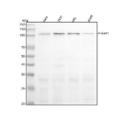 Anti-Phospho-KAP1 (S824) Rabbit Monoclonal Antibody Boster Bio