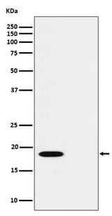 Anti-Phospho-PTS (S19) Rabbit Monoclonal Antibody Boster Bio