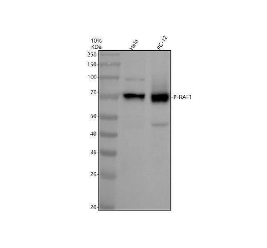 Anti-Phospho-Raf1 (S43) Rabbit Monoclonal Antibody Boster Bio