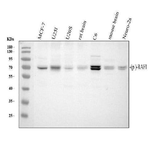 Anti-Phospho-Raf1 (S259) Rabbit Monoclonal Antibody Boster Bio