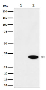 Anti-Phospho-Nucleophosmin (T199) Rabbit Monoclonal Antibody Boster Bio