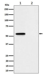 Anti-Phospho-MLKL (S345) Rabbit Monoclonal Antibody Boster Bio