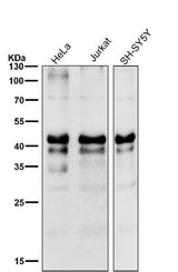 Anti-Phospho-Creb (S133) CREB1 Rabbit Monoclonal Antibody Boster Bio
